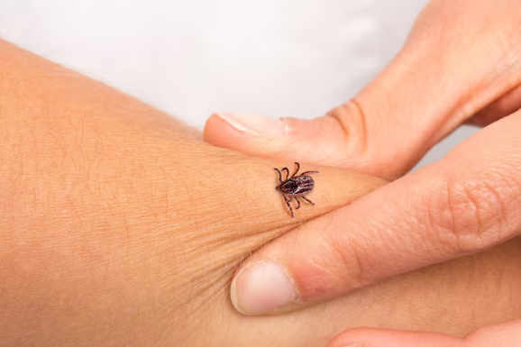 How to Get Rid of Ticks